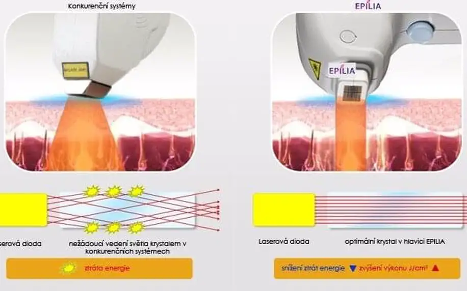 Permanentky na pánskou lékařskou laserovou epilaci