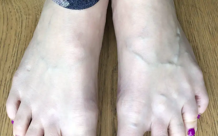 Pedikúra s masáží nohou a lakováním nehtů