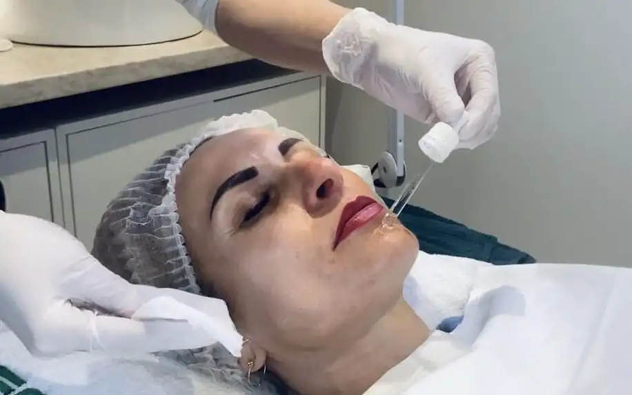 Chemický peeling obličeje, dekoltu či mezoterapie
