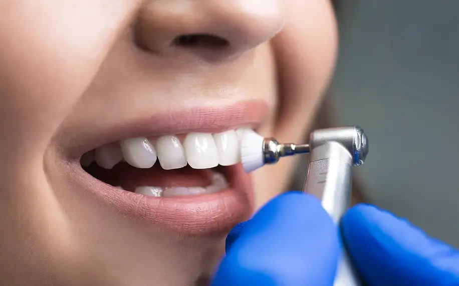 Komplexní dentální hygiena včetně pískování Air Flow